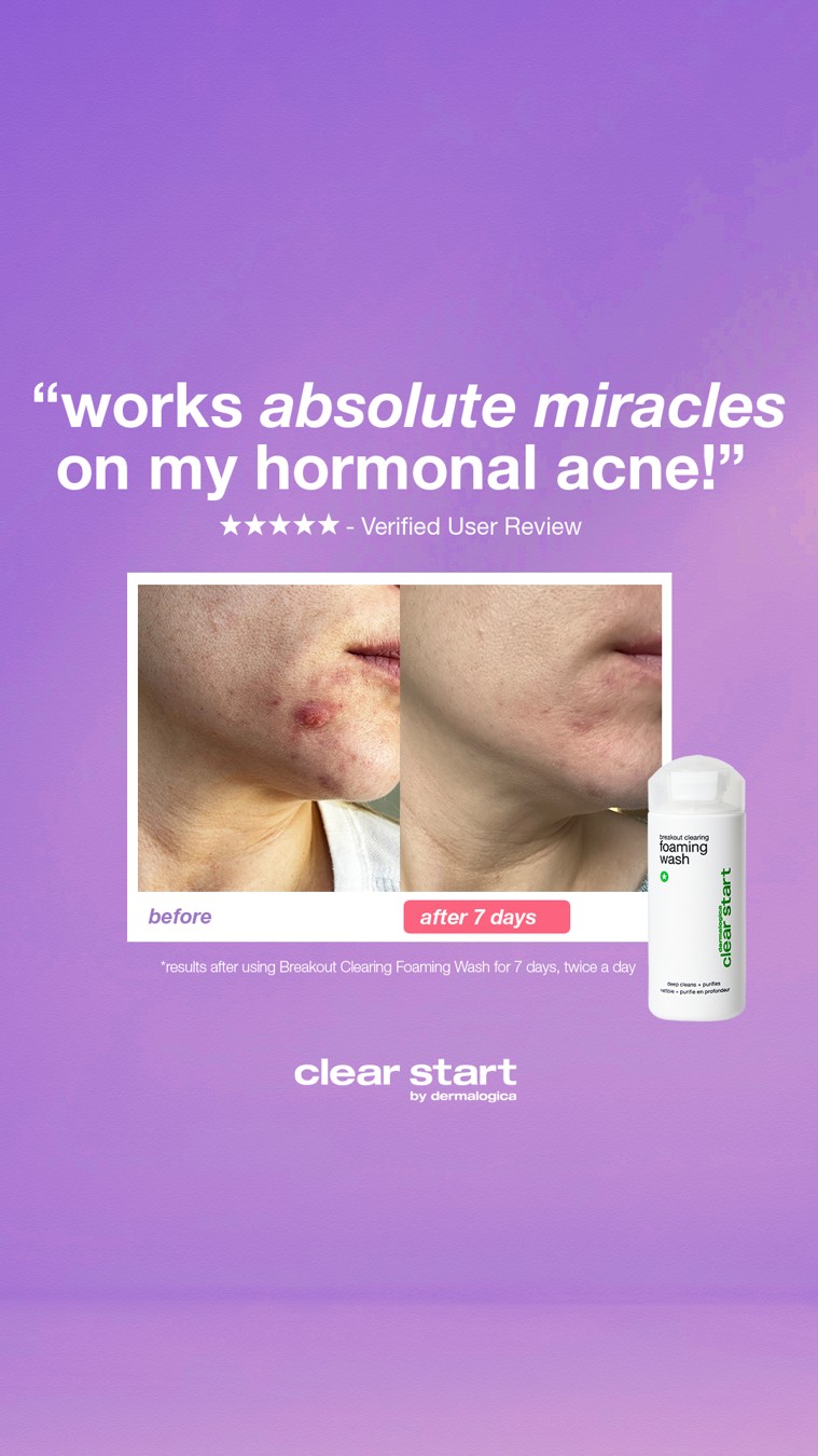Dermalogica static ad reference
