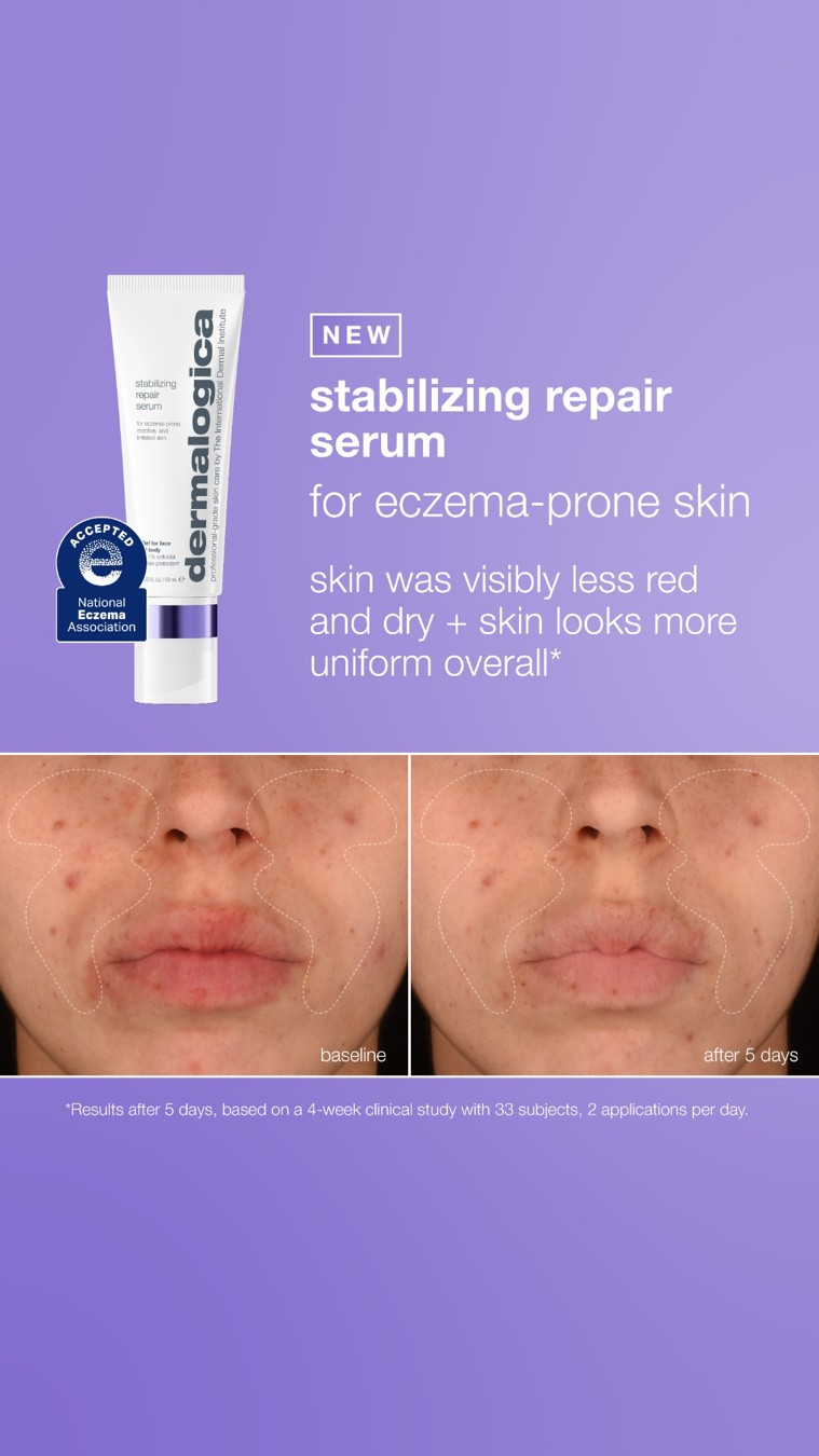 Dermalogica before and after ad reference
