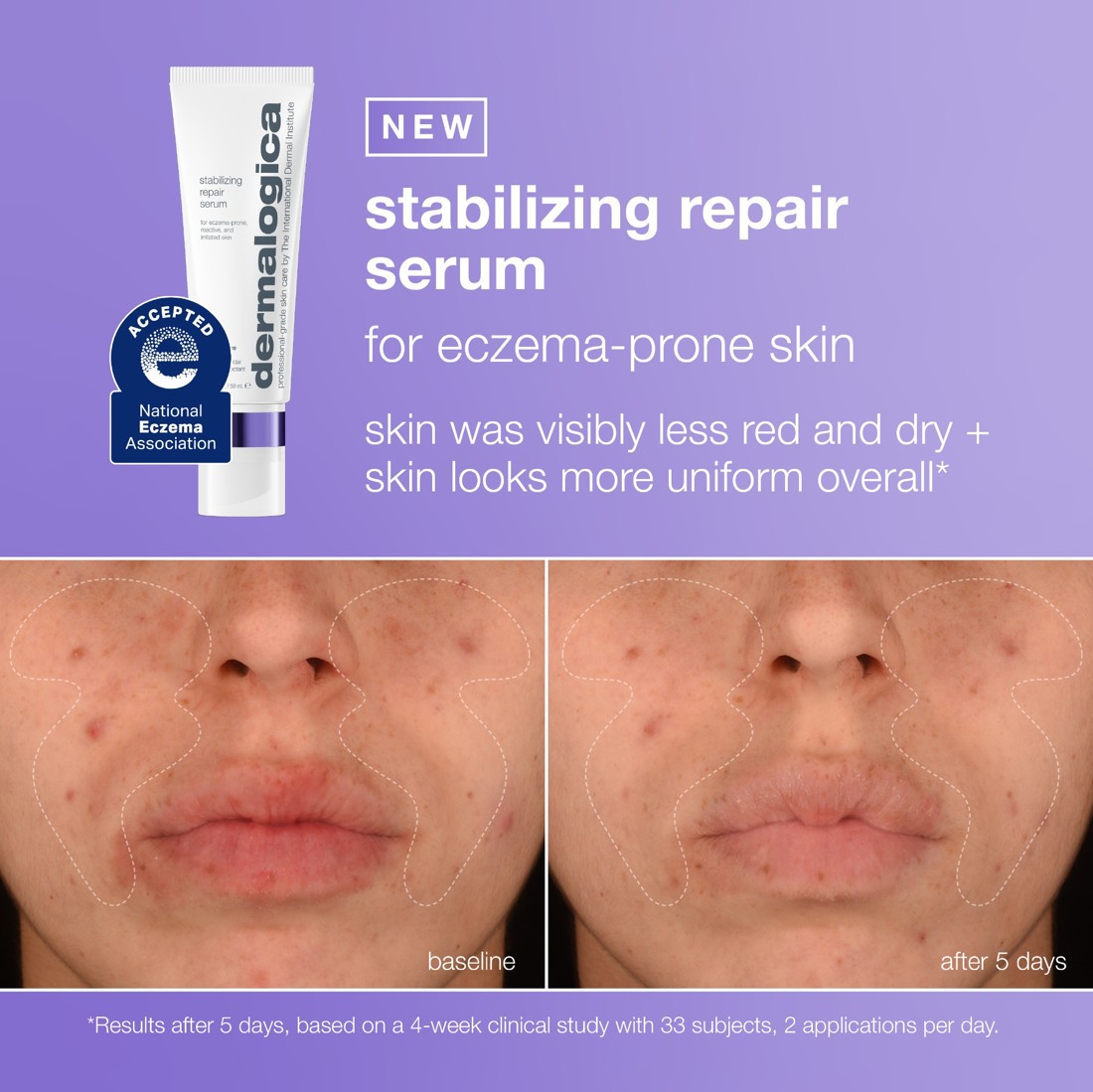 Dermalogica static ad reference